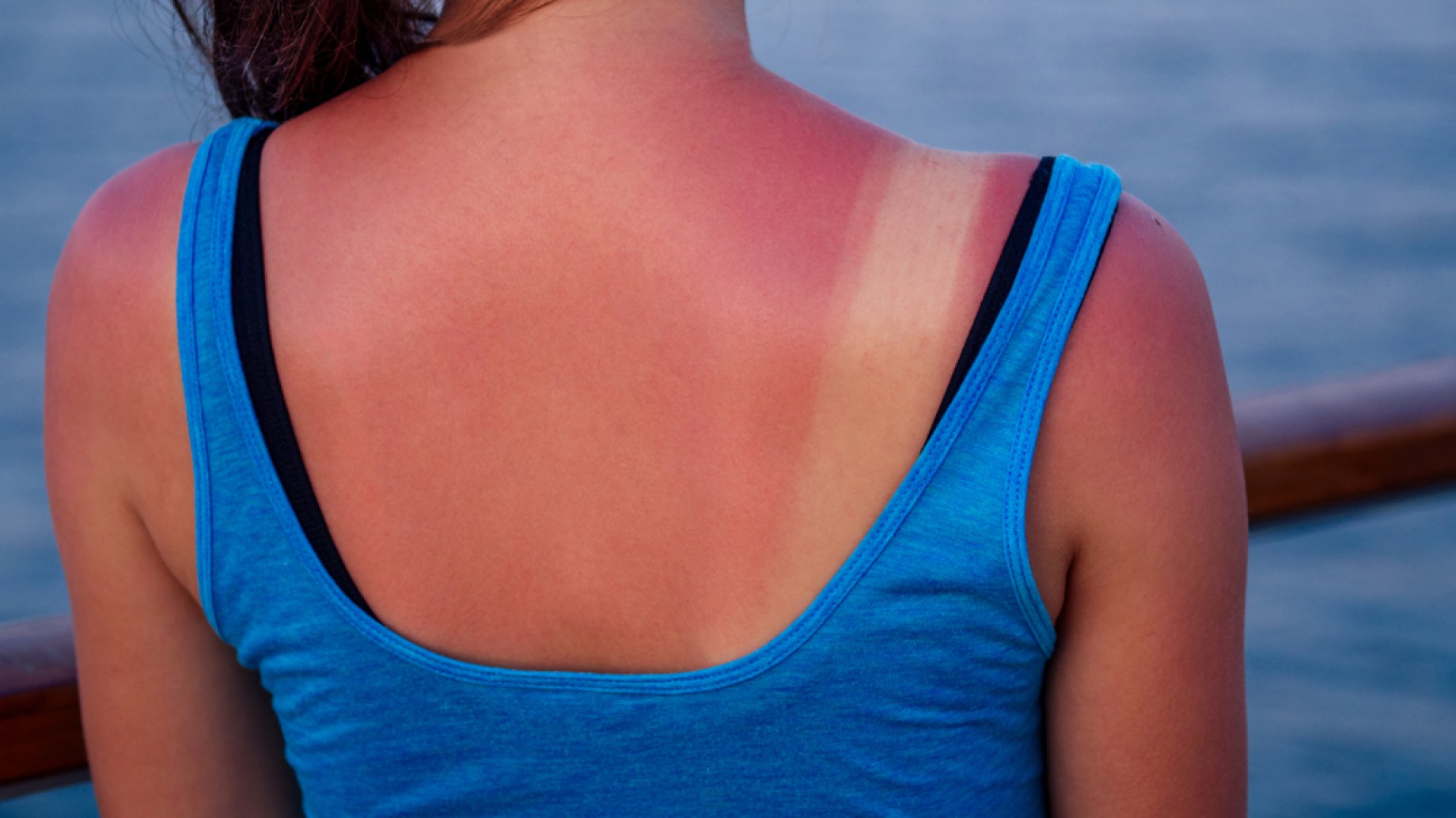 No se puede tapar el sol con un dedo: el cuidado responsable de la piel